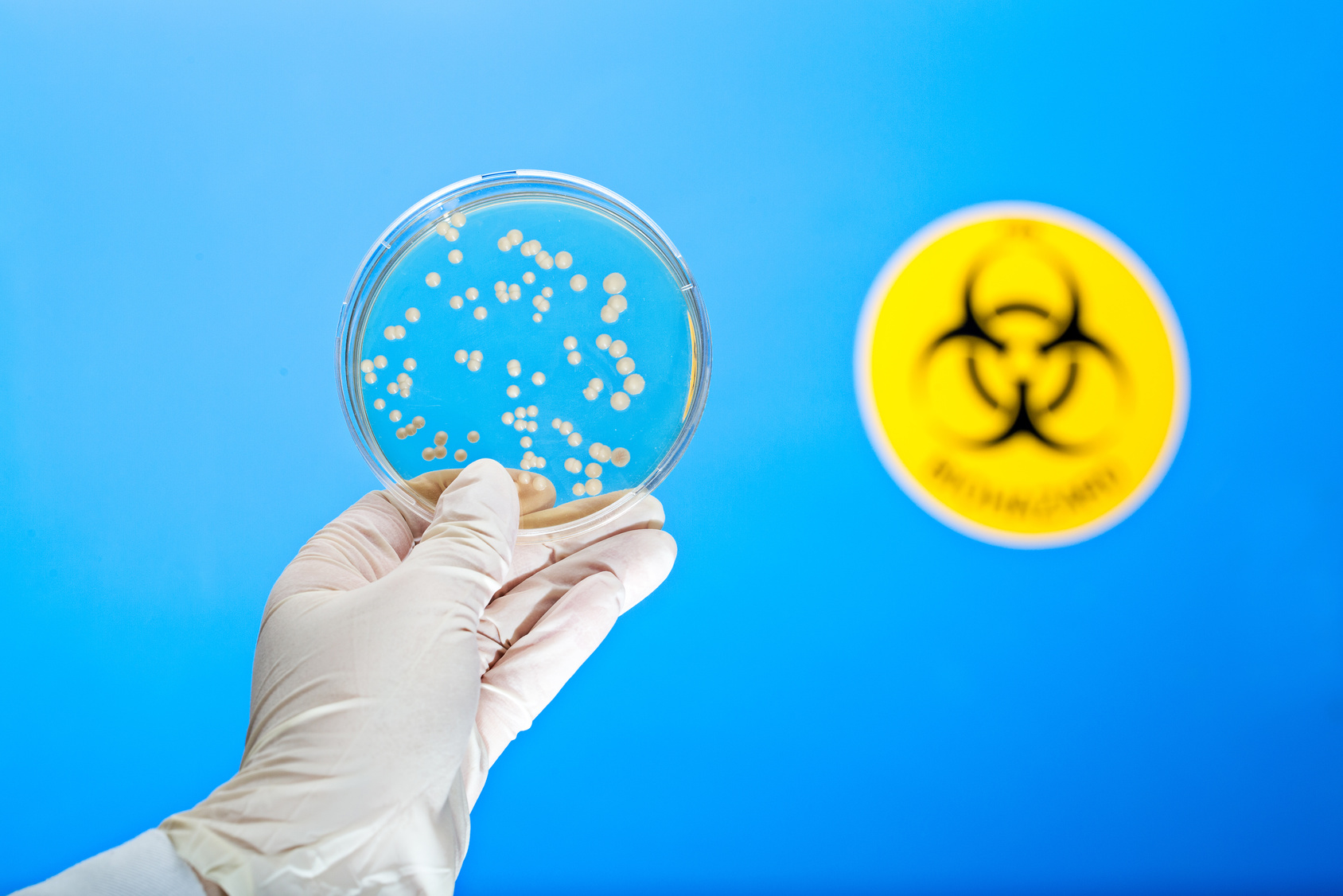 Valutazione rischio biologico